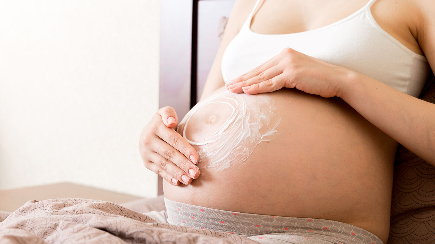 Estr&iacute;as durante el embarazo: causas, prevenci&oacute;n y remedios